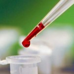 D’anciennes ruses de contraception